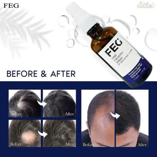 FEG PLUS Hair Growth Spray | FREE DELIVERY
