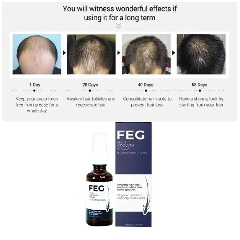 FEG PLUS Hair Growth Spray | FREE DELIVERY